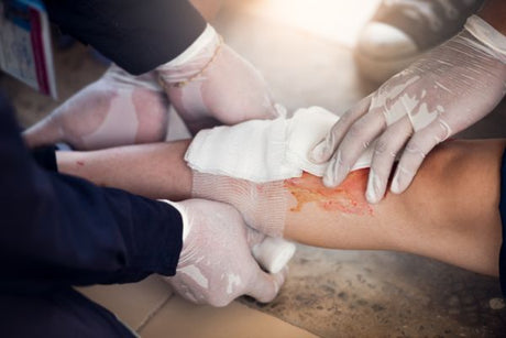 bleeding hand