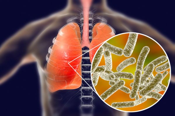 legionella virus